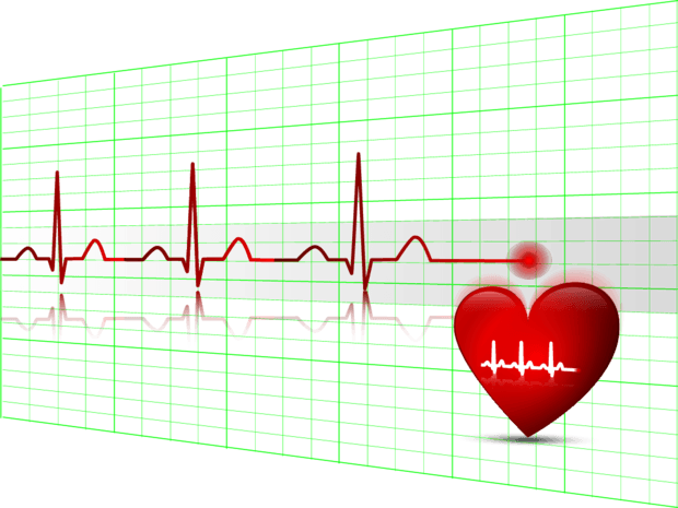 心电图图片大全